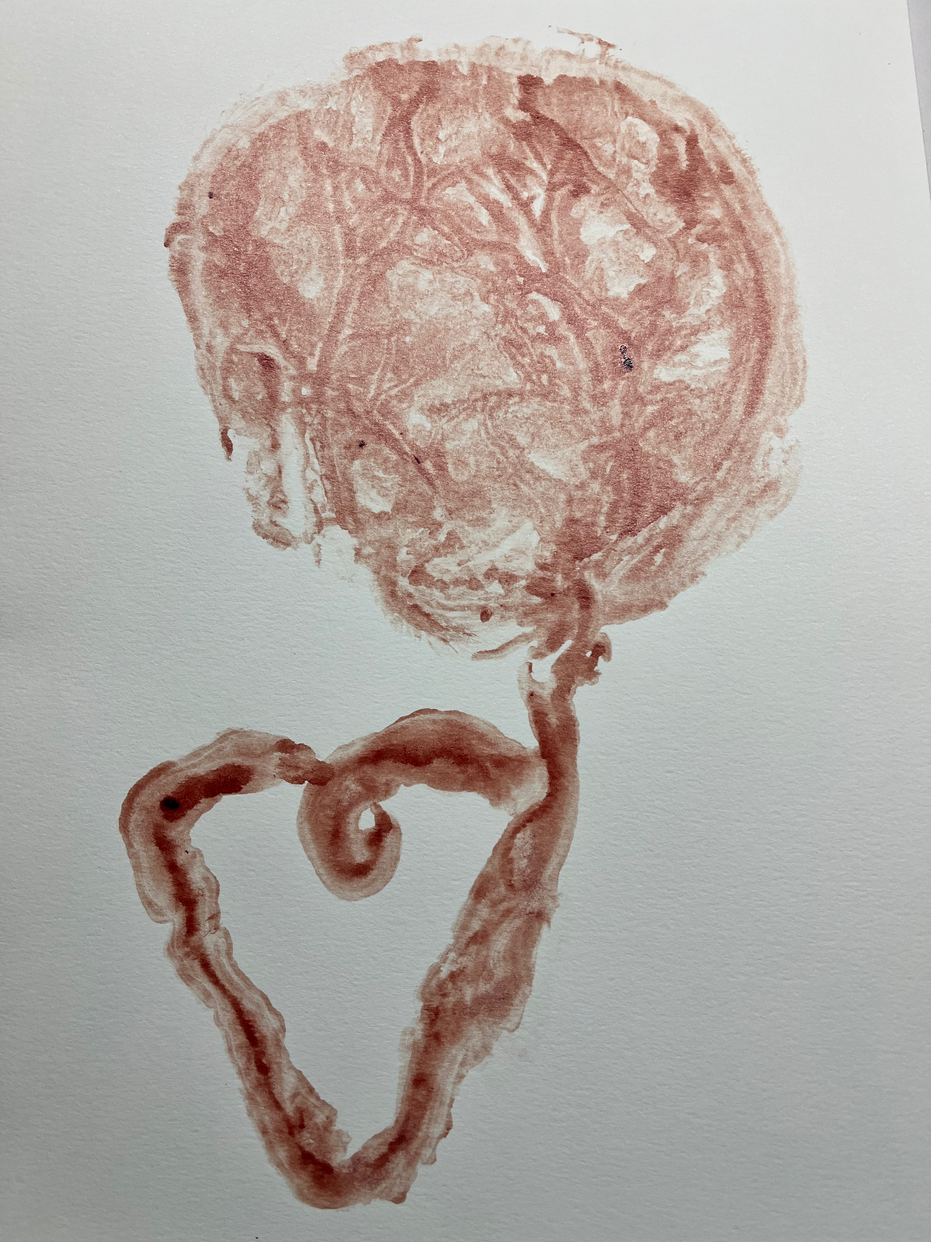 standard [blood] placenta art print