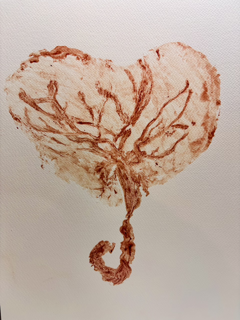 standard [blood] placenta art print