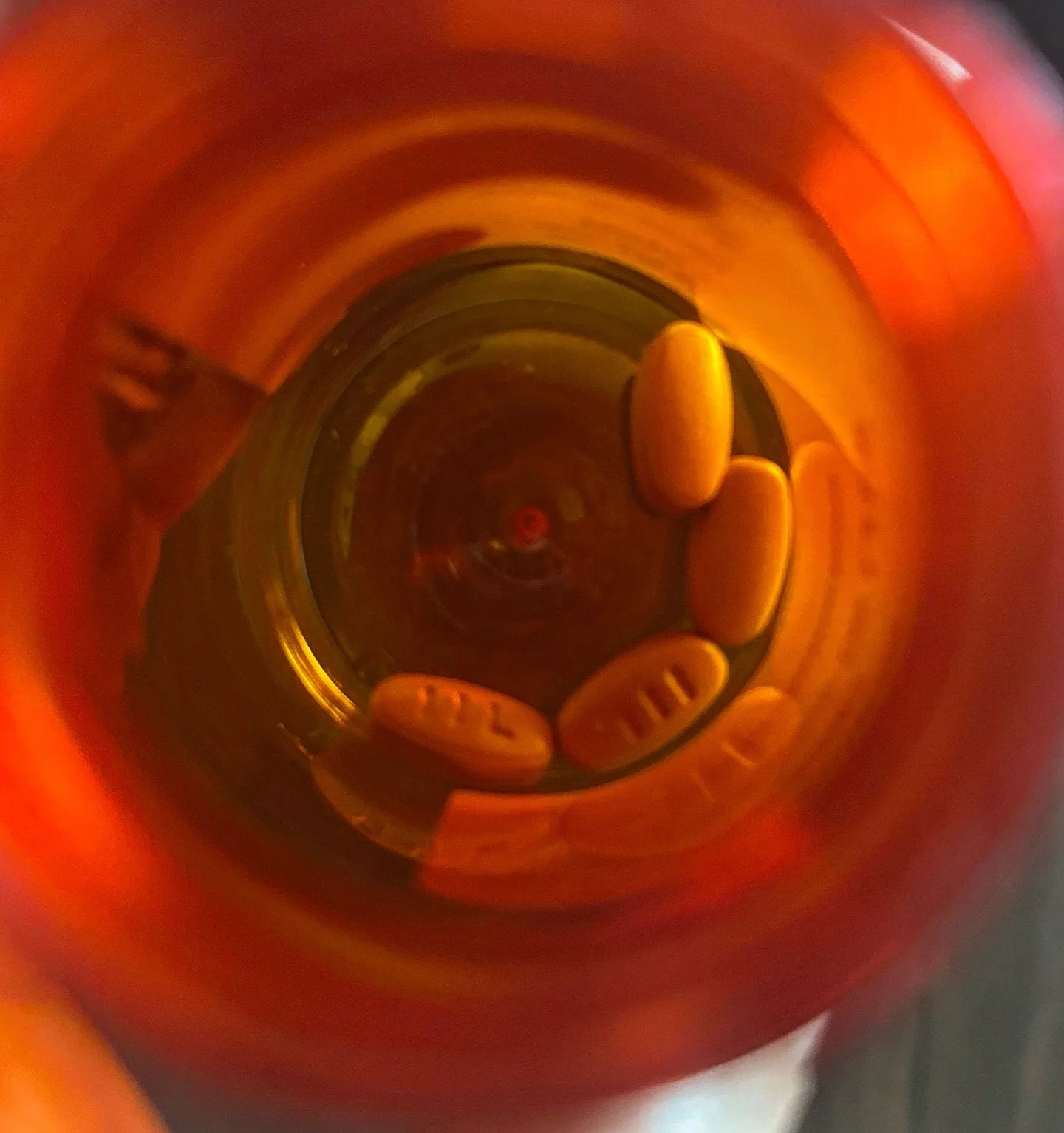 Some takeaways from my recent colonoscopy and blood work 🩺

1️⃣ Diverticulosis: They spotted small pouches on my colon lining. Pretty common for people 40+ but can turn into diverticulitis if inflamed (see image).

2️⃣ White blood count: 3.0 (normal