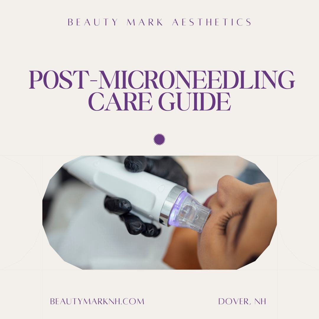 After microneedling there is some post-care that needs to be followed. Check out these tips to have the best outcomes after your treatment! 

Schedule your microneedling service today⬇️
📞603-263-4752 call/text
💭DM us on IG
🗓️visit the booking link