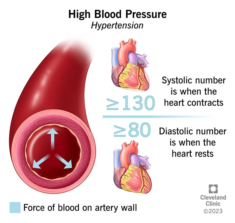 Hypertension is one of the most significant health issues in the world and can be dangerous if massage therapists are not aware of how to discuss and watch for it during client care