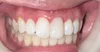 THE BIOCLEAR MATRIX SYSTEM — Maribel M. Vann DDS