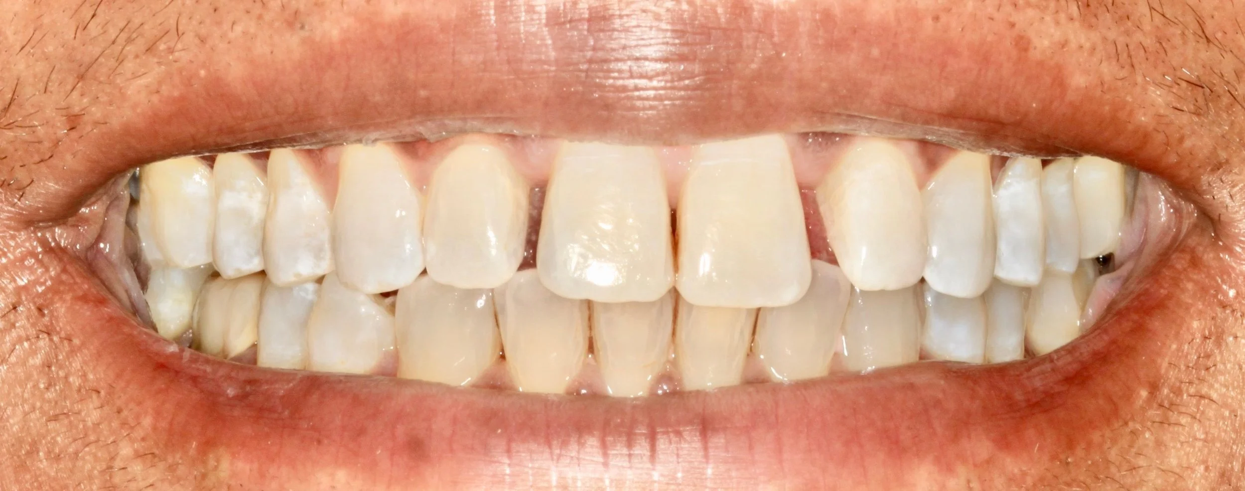 THE BIOCLEAR MATRIX SYSTEM — Maribel M. Vann DDS