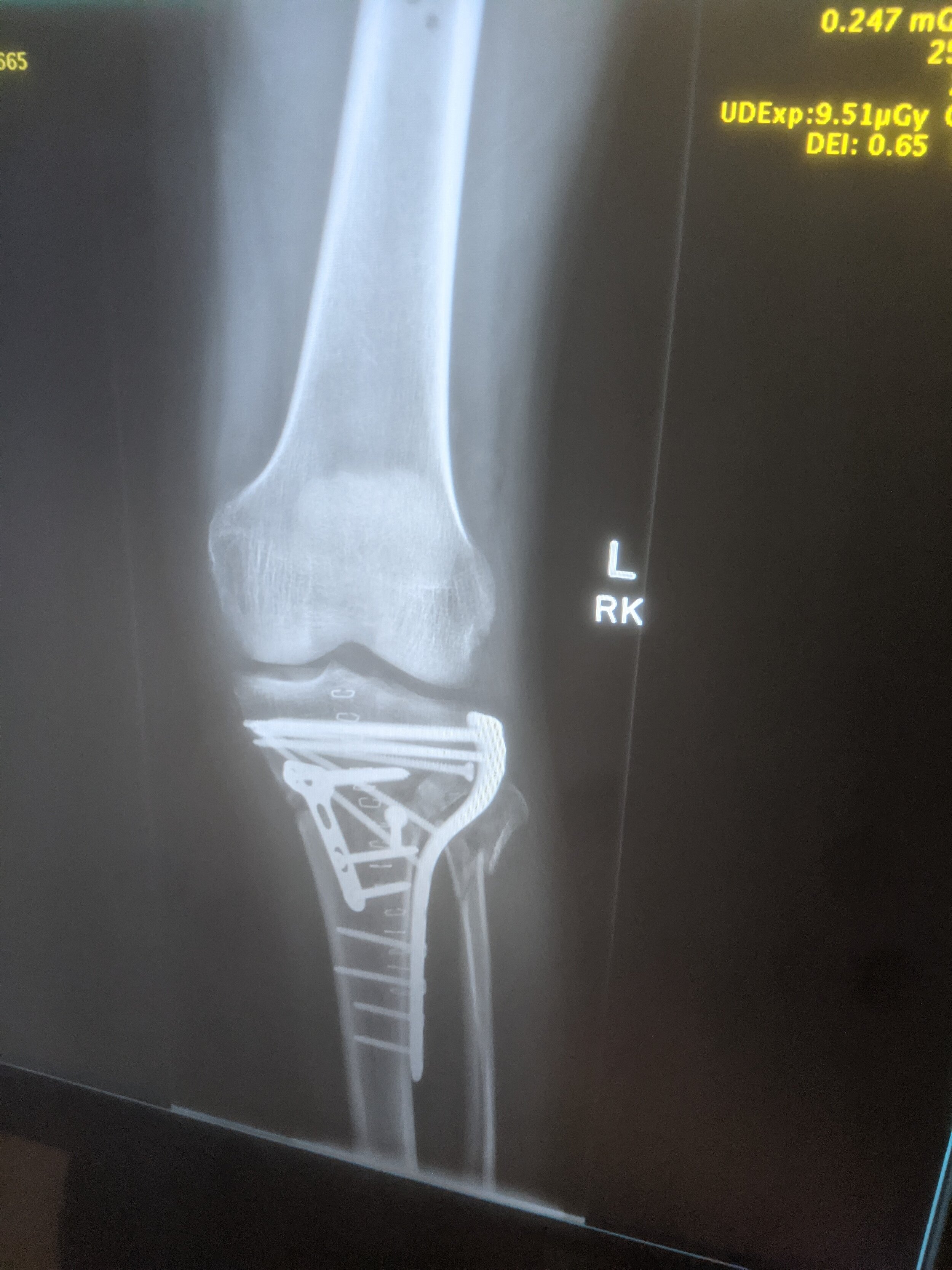 xray.jpeg