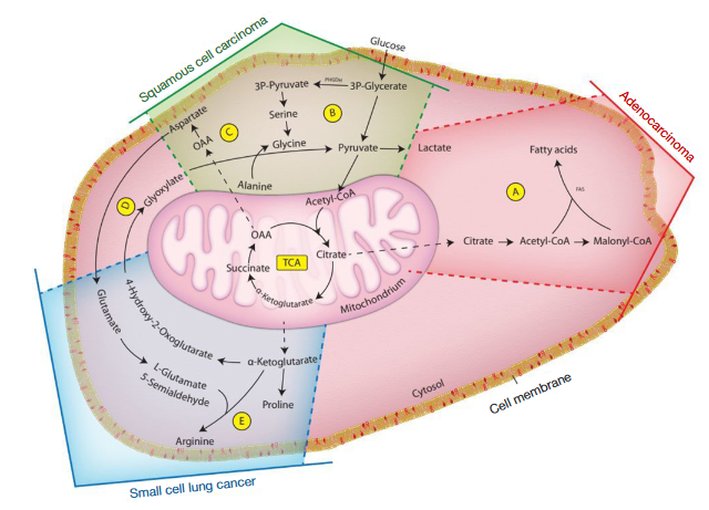 Real-time breath metabolomics as catalyst for personalized lung cancer diagnostics: prospective matched case-control trial (LUCAbreath)