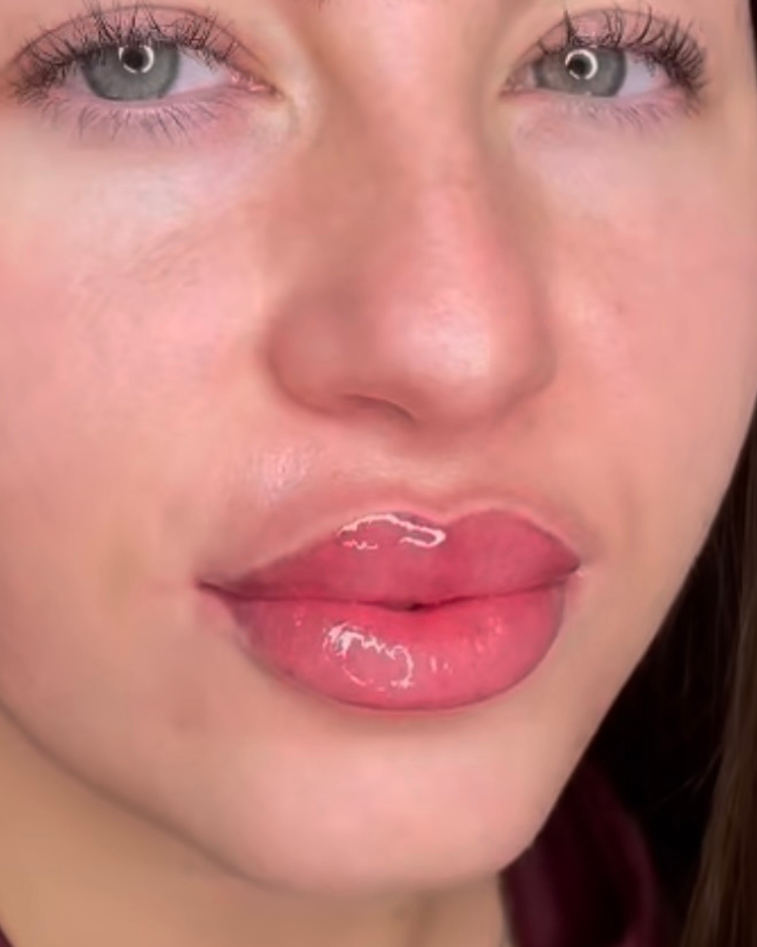 113.png