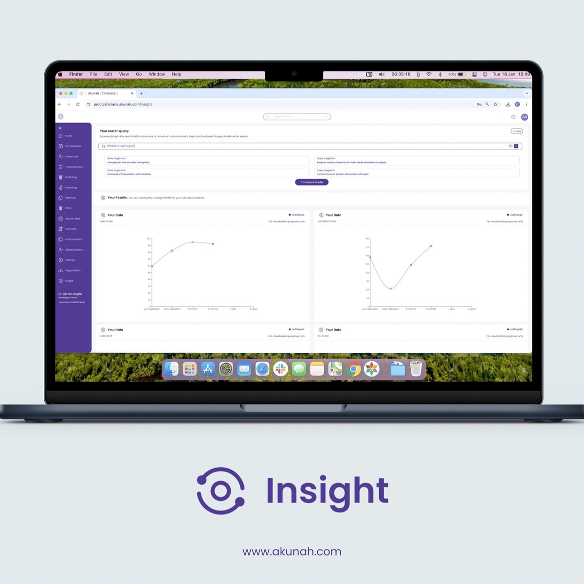 AI Analytics Driving Orthopaedic Excellence