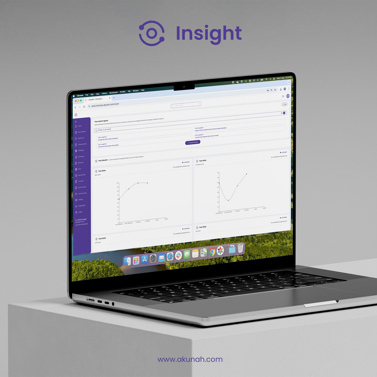 AI in Orthopaedics: Breakthrough Showcase at SECEC
