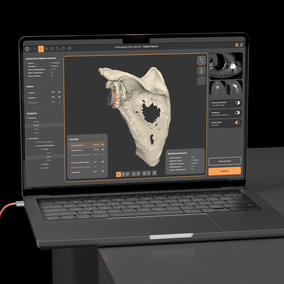 Akunah Reflect Release!