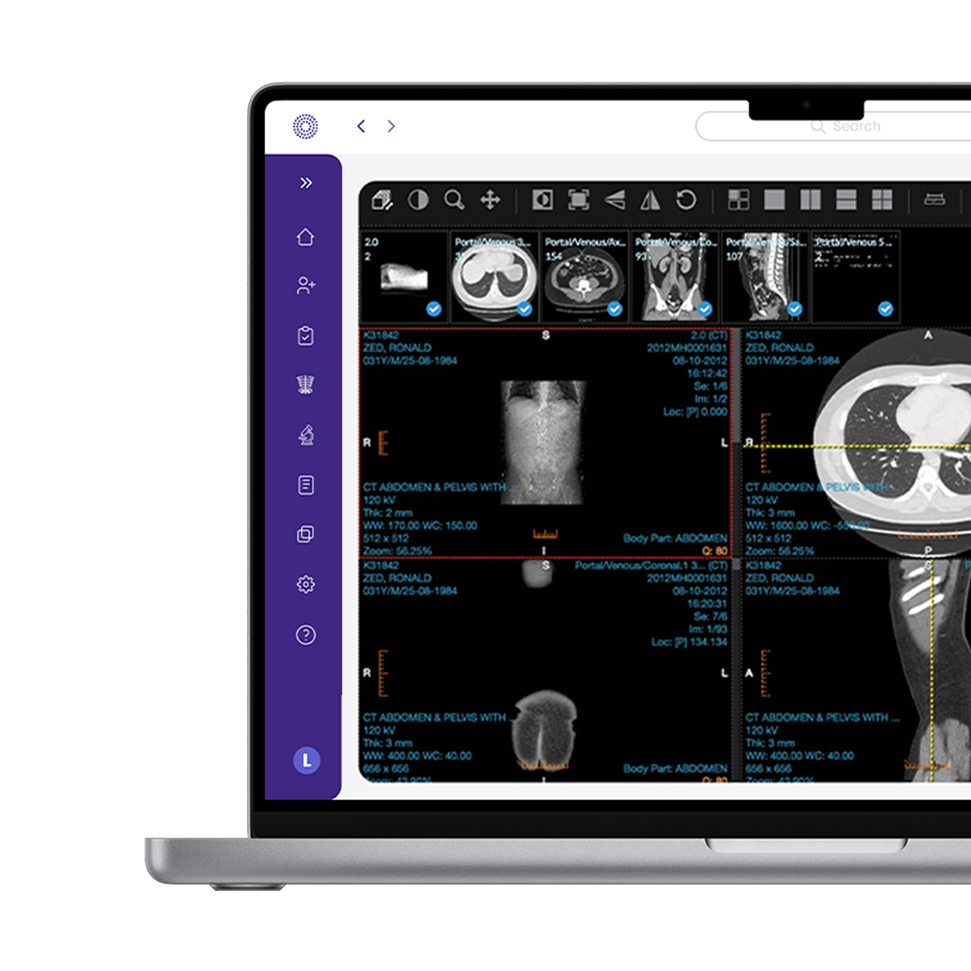 Computer screen displaying multiple medical imaging scans, including CT scans of the abdomen and pelvis.