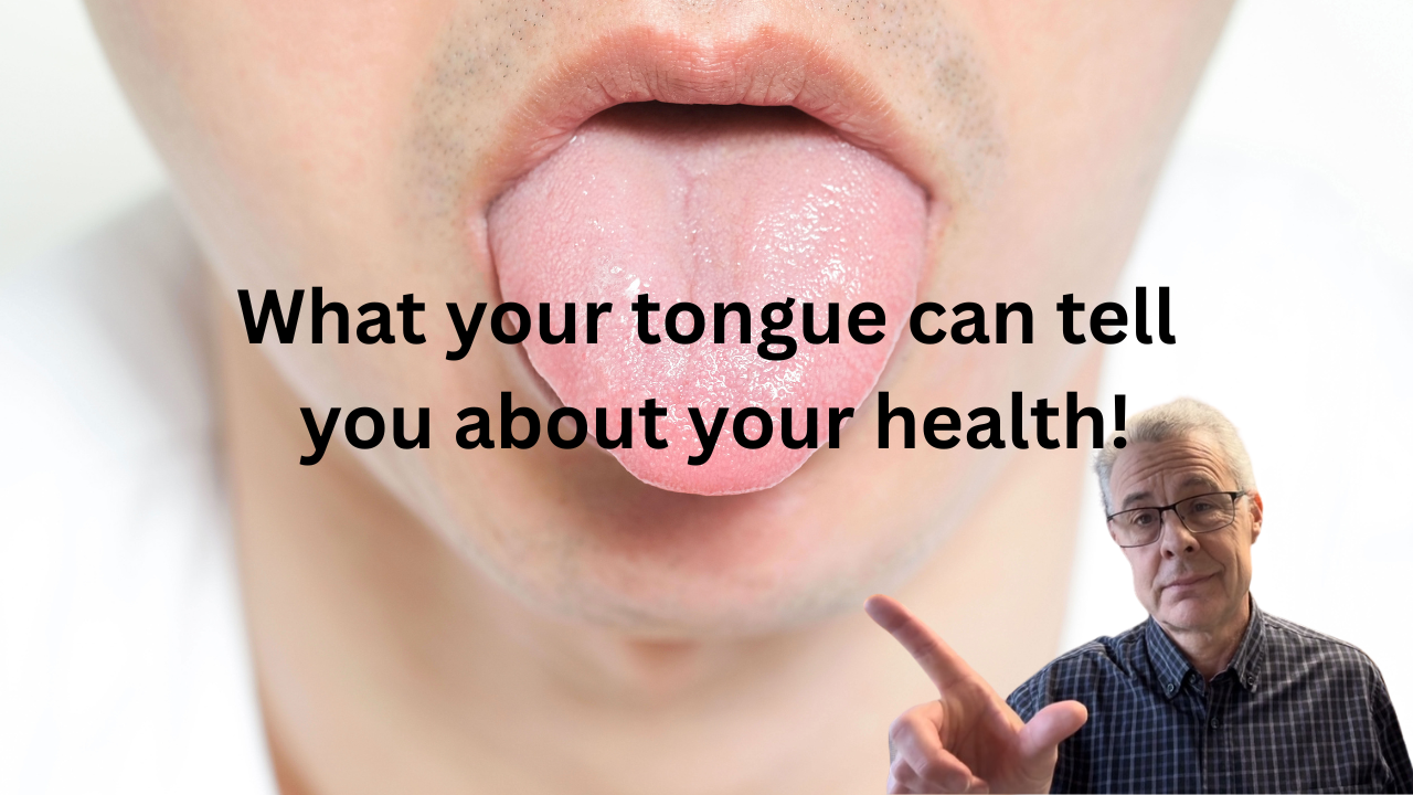 What your tounge can tell you about your health