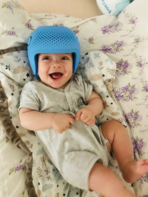 Laughing baby in a cranial helmet