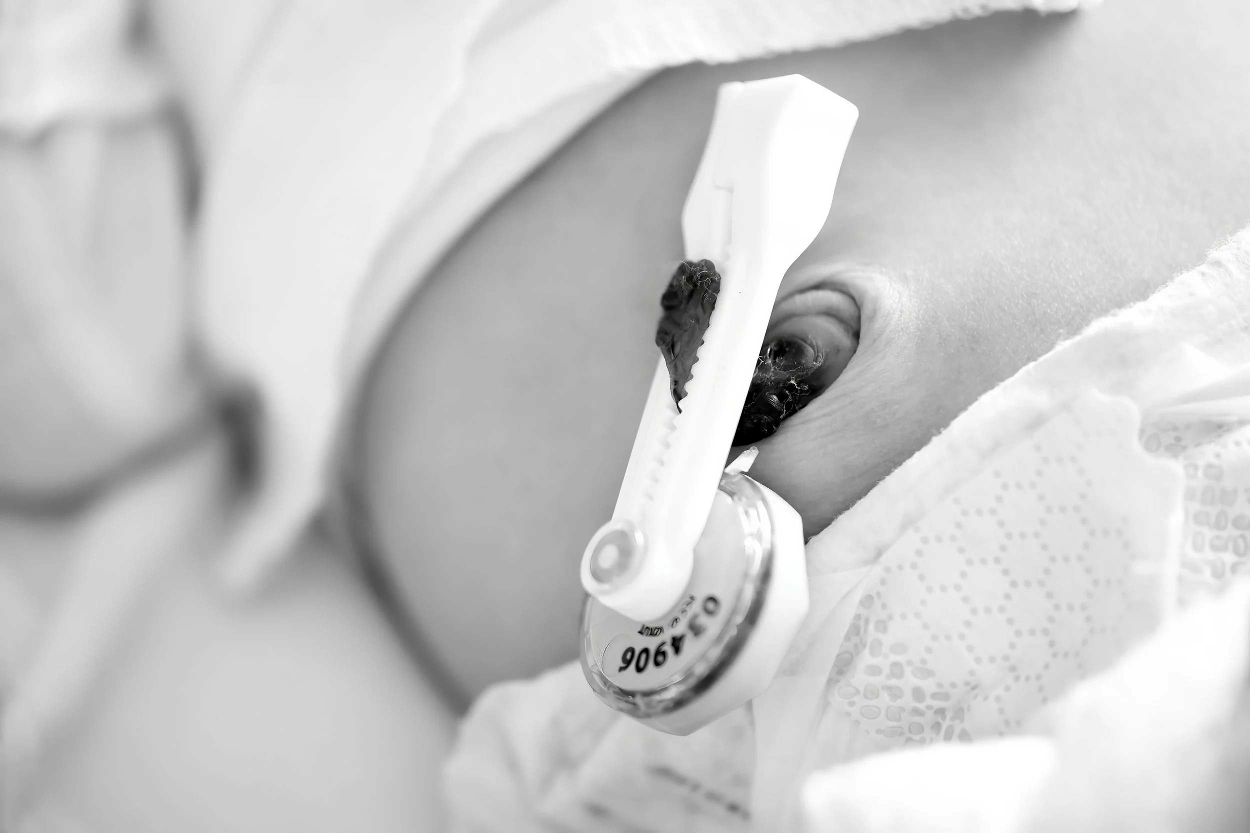 Close-up of a newborn baby belly button, near a hospital wristband, on a bed with polka dot sheet.
