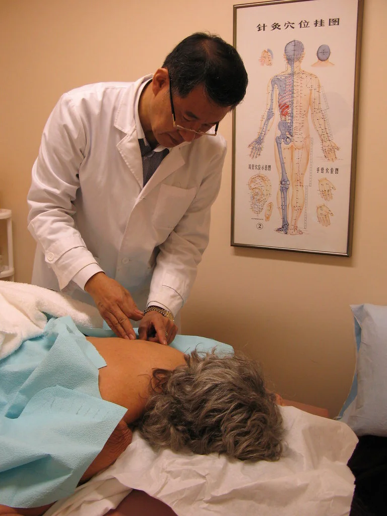 Dry Needling vs Acupuncture