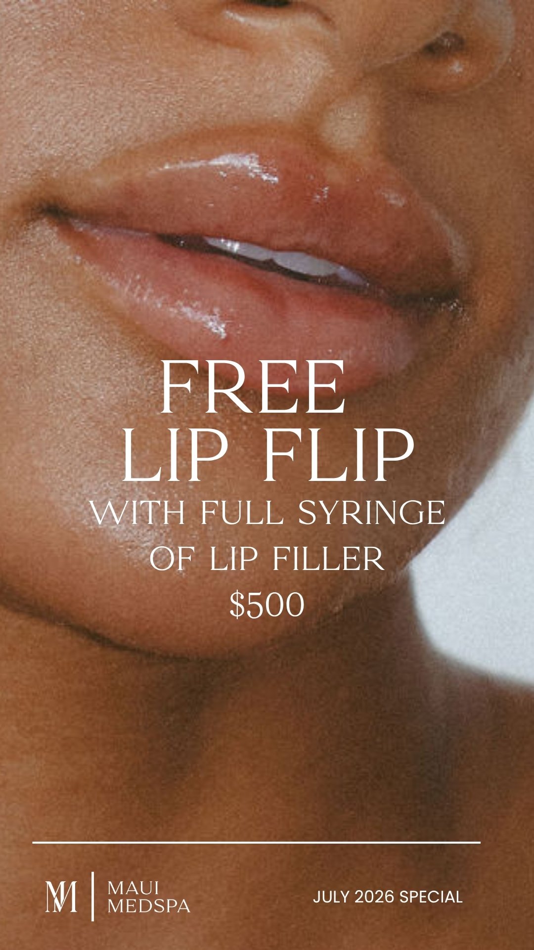Free Lip Flip