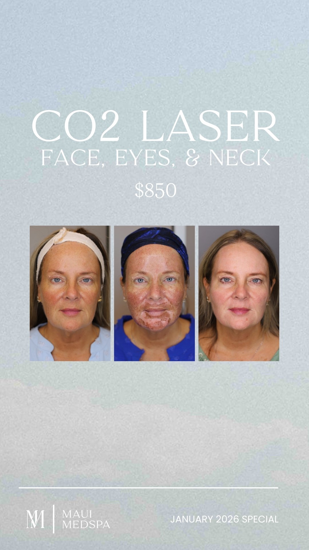CO2 Laser in Austin TX