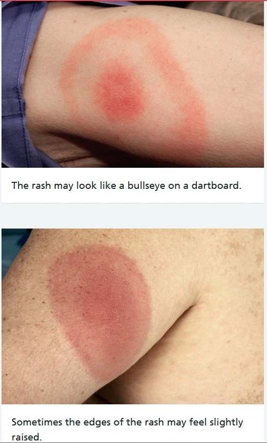 Ticks are not an Acquired Taste - but Humans are! — Wilderness Wood