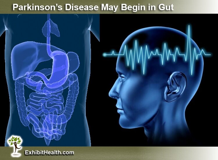 Parkinson’s May Begin In Gut Before Affecting The Brain : New research in mice and human cells indicates a brain-gut connection. by Amanda Onion