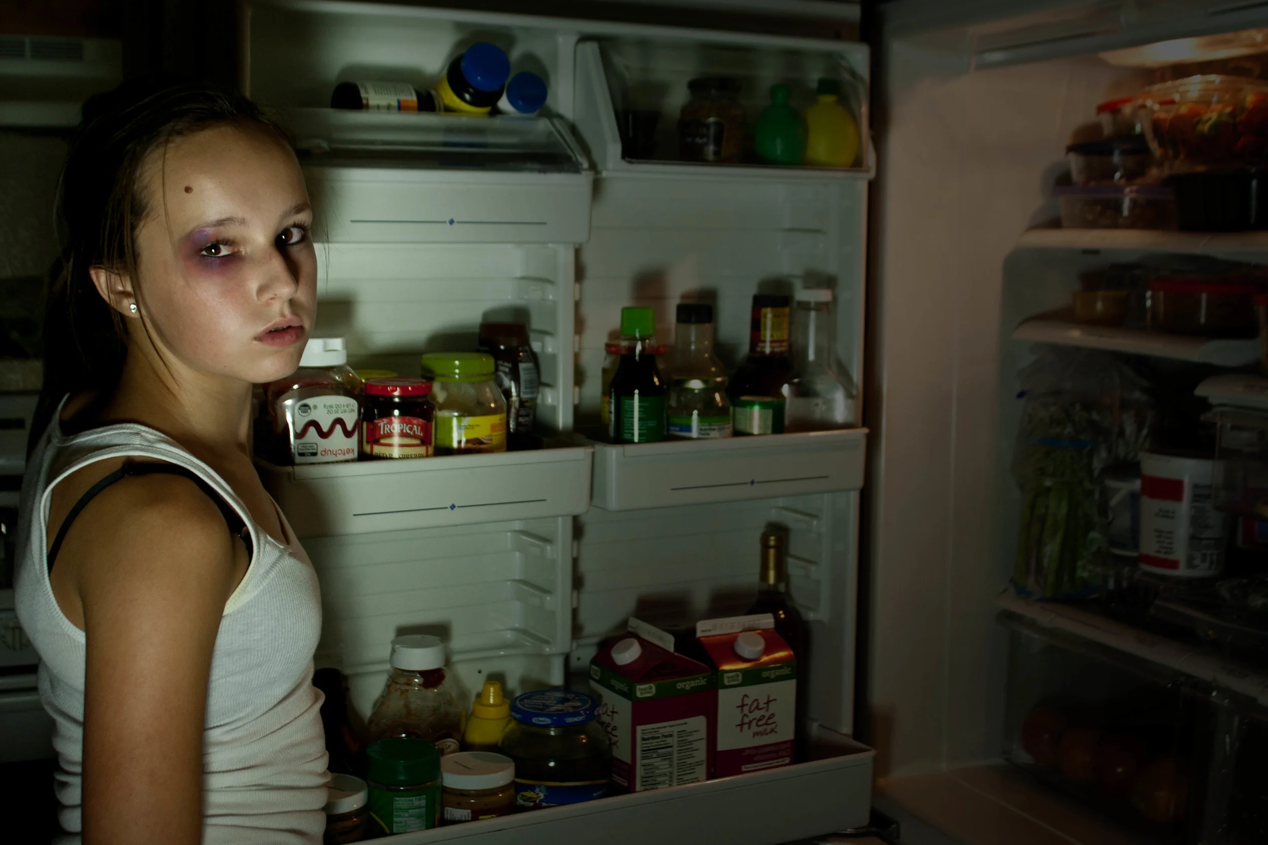 2011-09sofie-black eye1.jpg