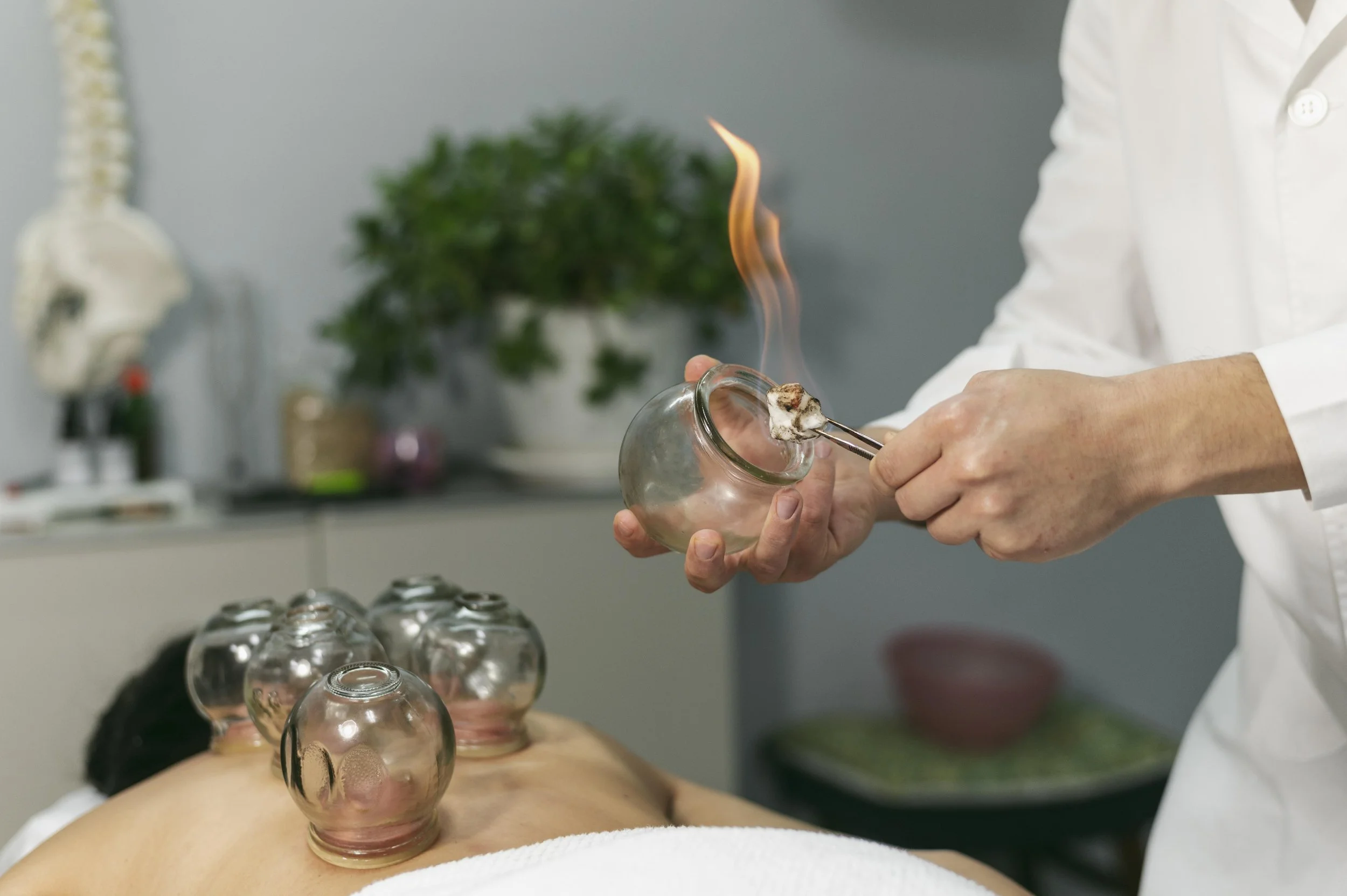Fire Cupping 101