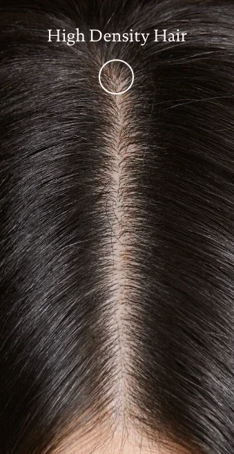 Low+Density+Hair.webp