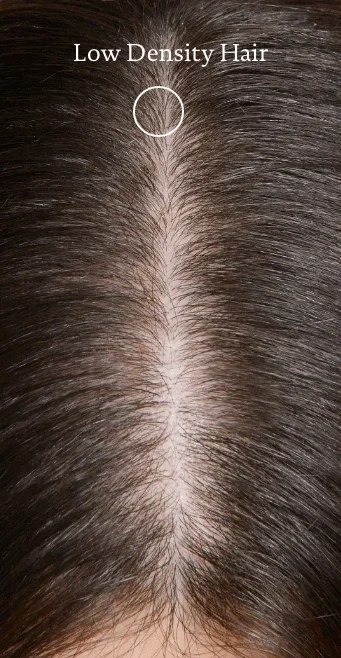 Low+Density+Hair.webp