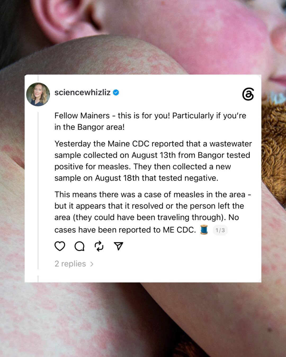 This is for my Maine followers or those who know people in Maine. 💕 

Yesterday the Maine CDC reported that a wastewater sample collected on August 13th from Bangor tested positive for measles. They then collected a new sample on August 18th that te