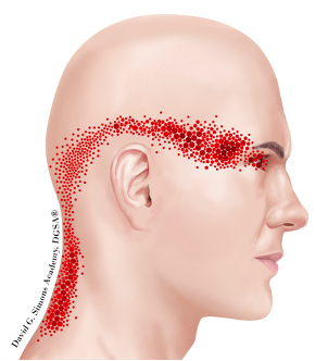 Céphalées, diagnostic et … kinésithérapie ? — Agence EBP