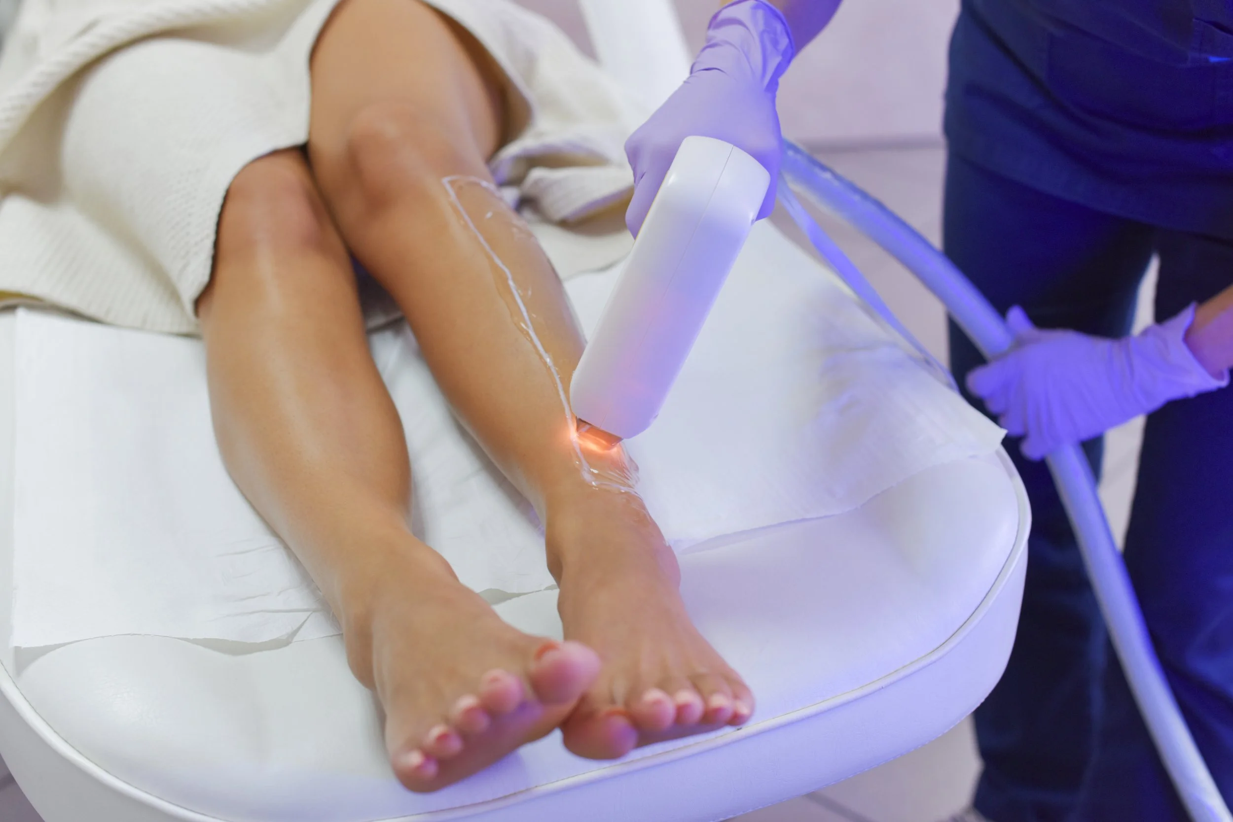 Person receiving laser hair removal on legs in a clinic.