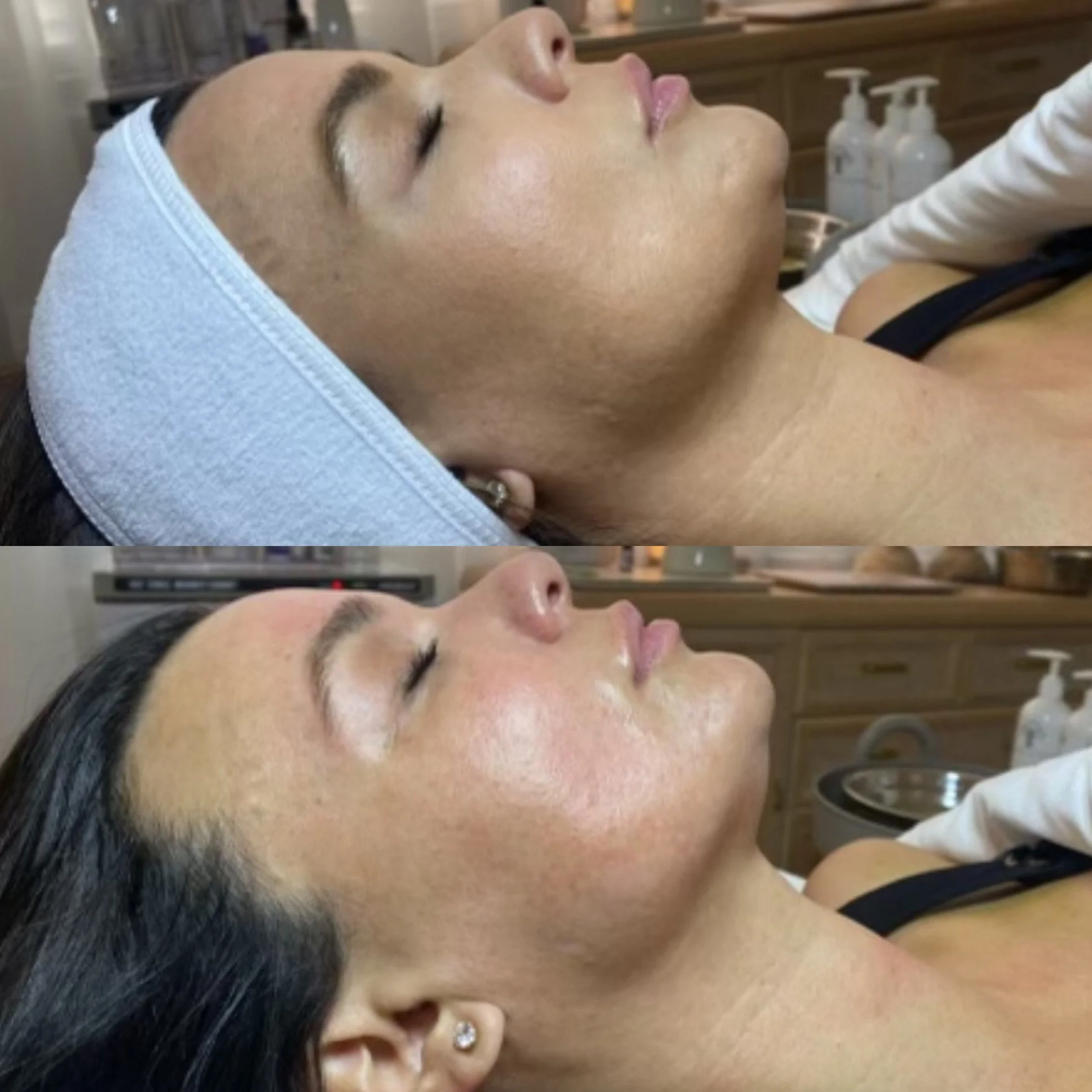 Silk Med Spa