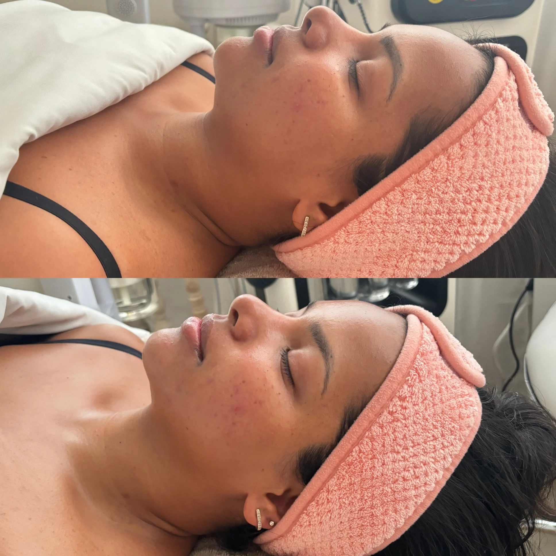 Silk Med Spa