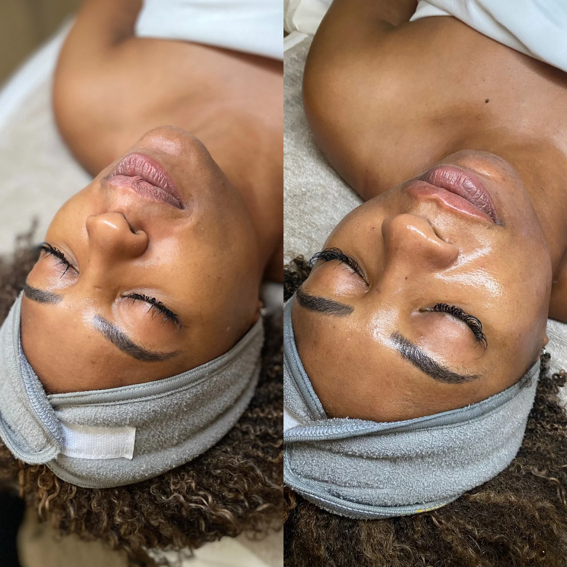 Silk Med Spa