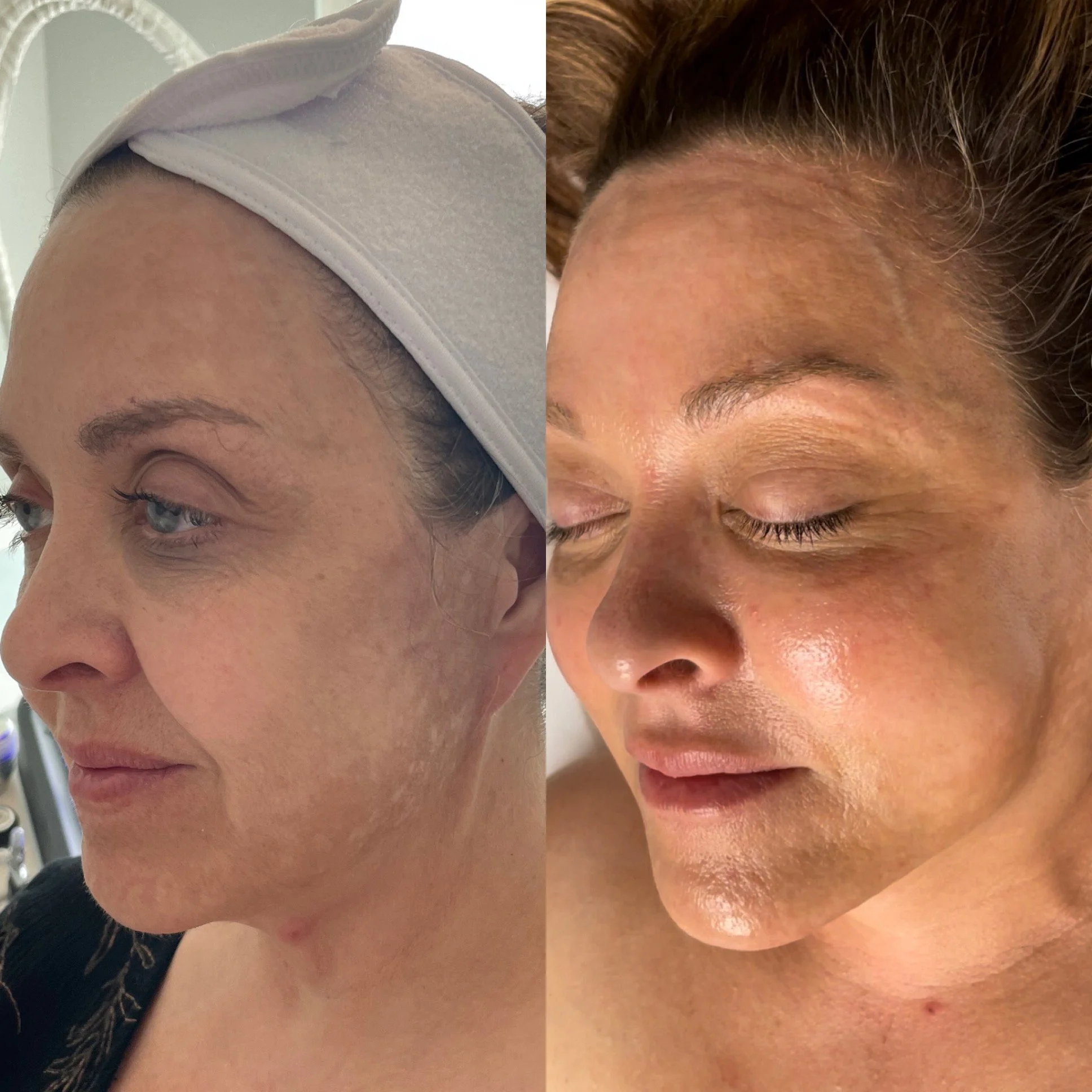Silk Med Spa