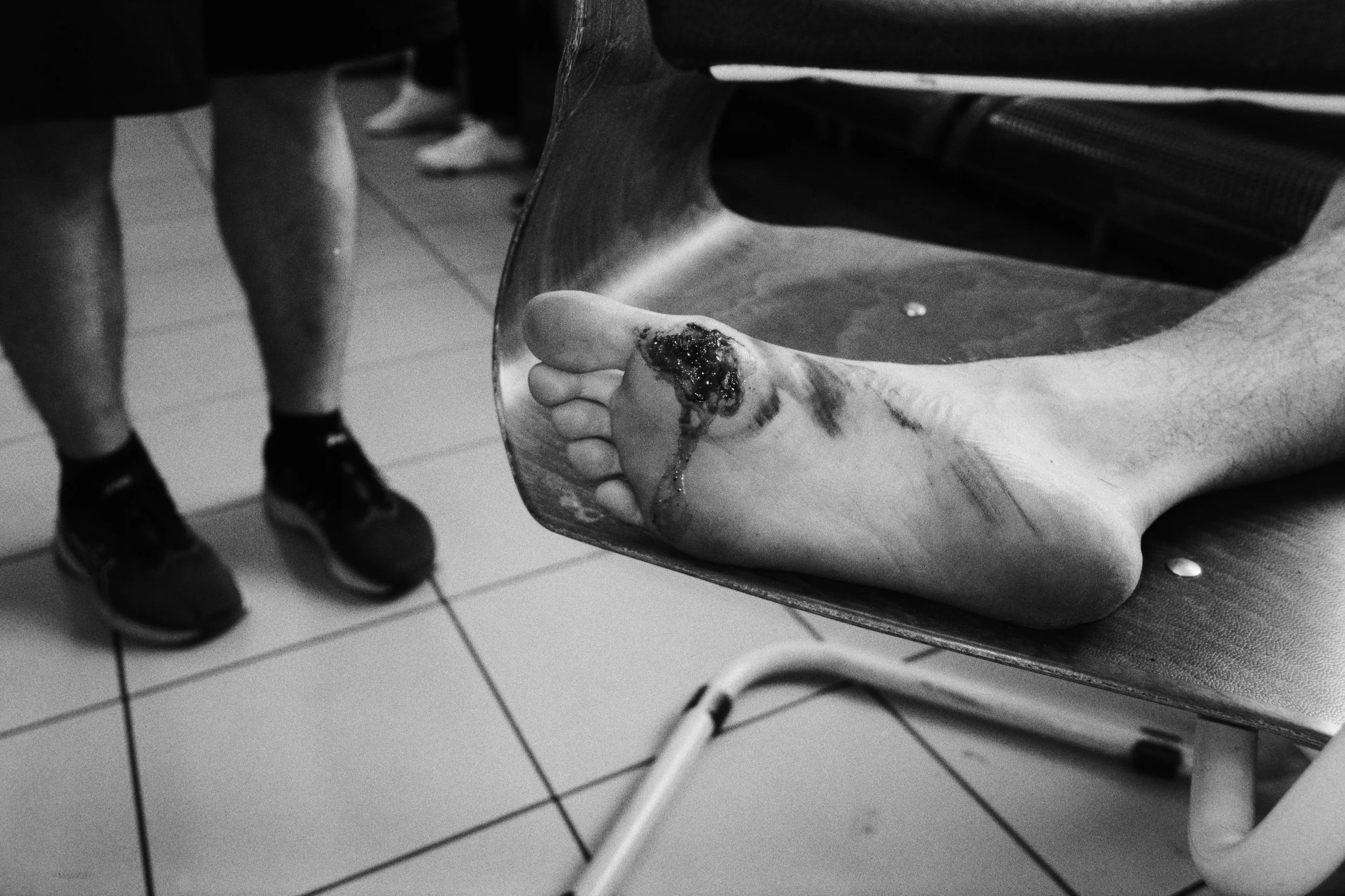 Csombor's foot was injured in a bicycle accident on a class trip. 2026.