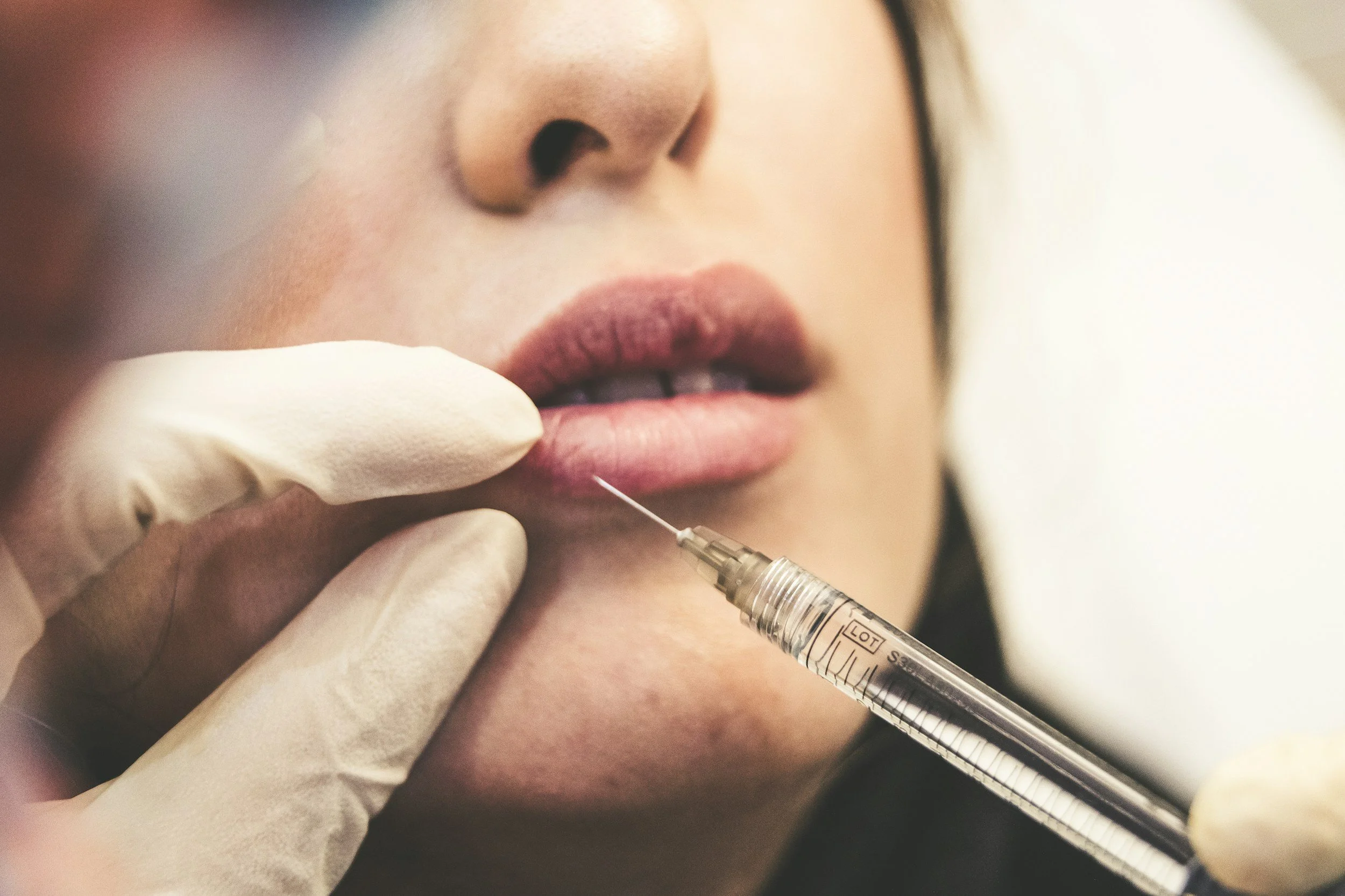 Jawline Filler in Oklahoma: What to Expect and How Long It Lasts at TAP MedSpa