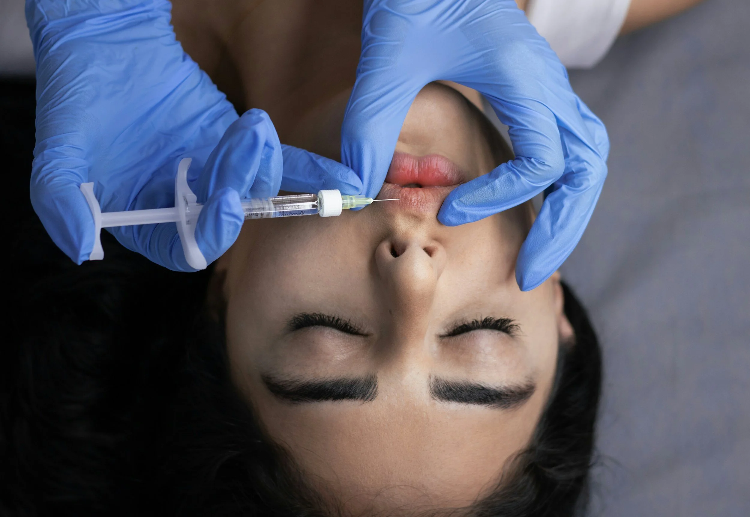 Jawline Filler Treatment at The Aesthetics Place MedSpa Mustang Oklahoma
