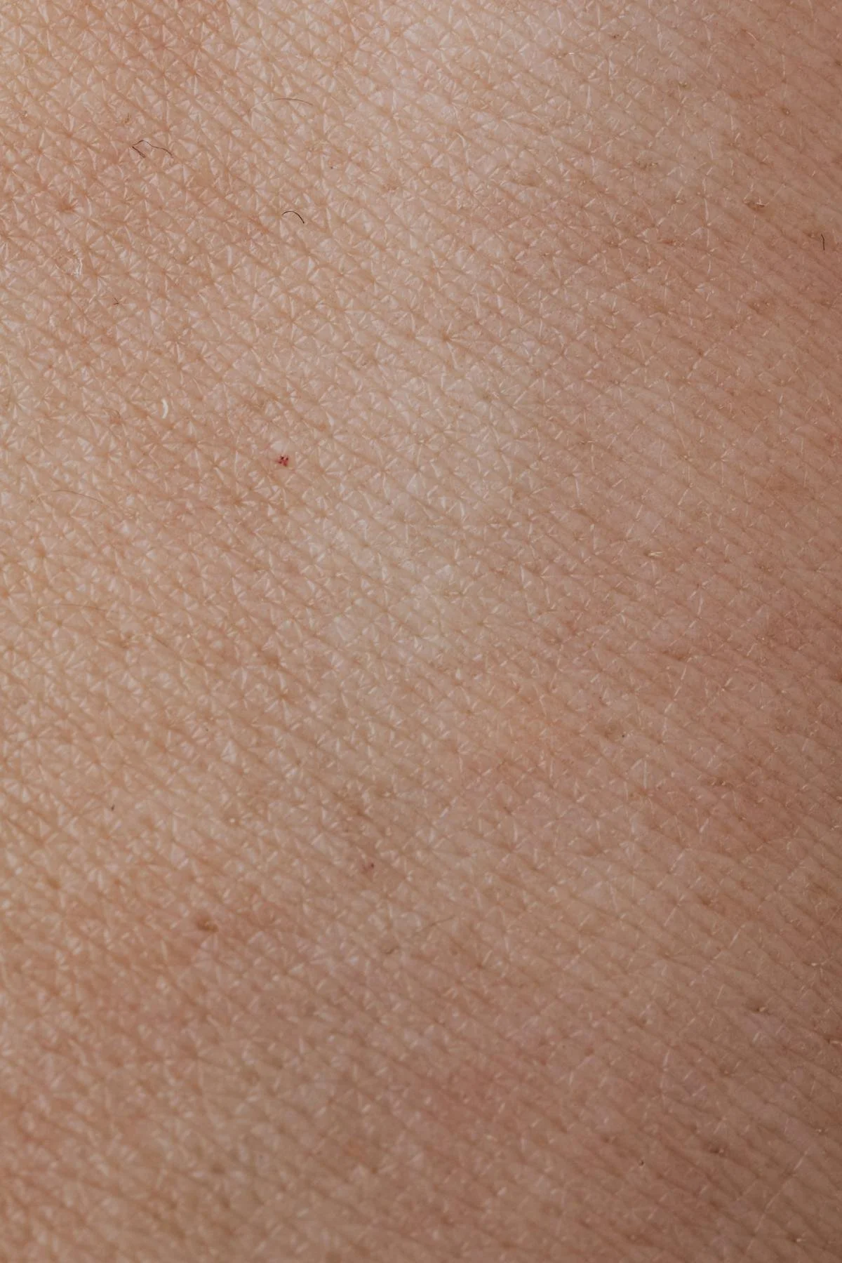 What the Optic Elite Skin Analysis at TAP MedSpa Actually Shows — and Why It Matters