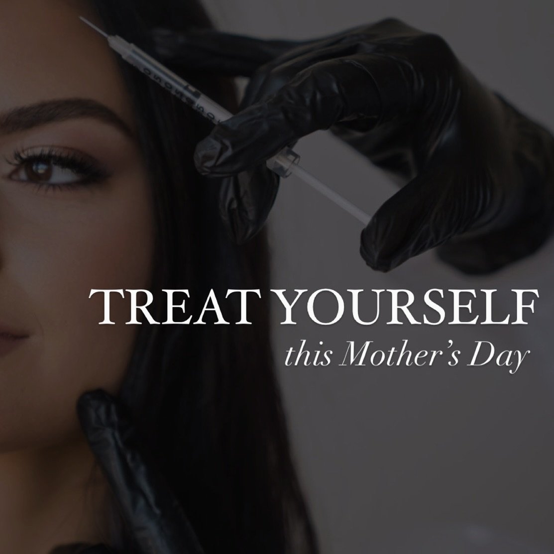 💖 Treat yourself this Mother&rsquo;s Day! 💖 Whether it&rsquo;s Botox, lip fillers, laser hair removal, or any other pampering you desire, we&rsquo;ve got you covered at THE LUXE MEDSPA. 

Because every mom deserves a little extra love and self-care