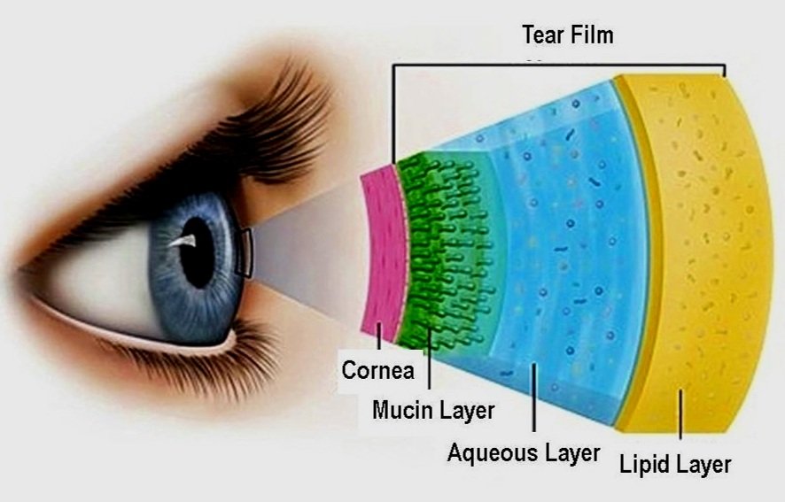 Did You Know…There are Several Causes of Dry Eye?