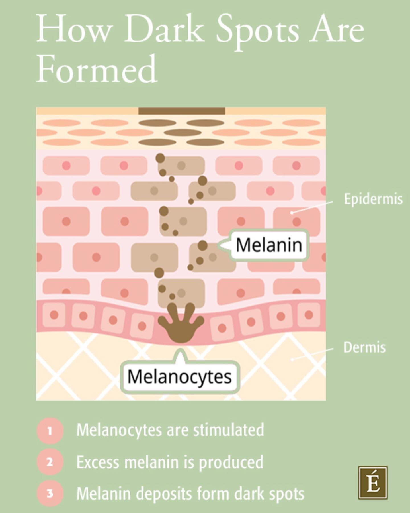 What Causes Dark Spots?
Whether you&rsquo;re dark or fair, your skin contains a pigment called melanin. Produced by cells called melanocytes, melanin acts as a form of protection for skin. However, when hyperpigmentation occurs, your skin produces ex