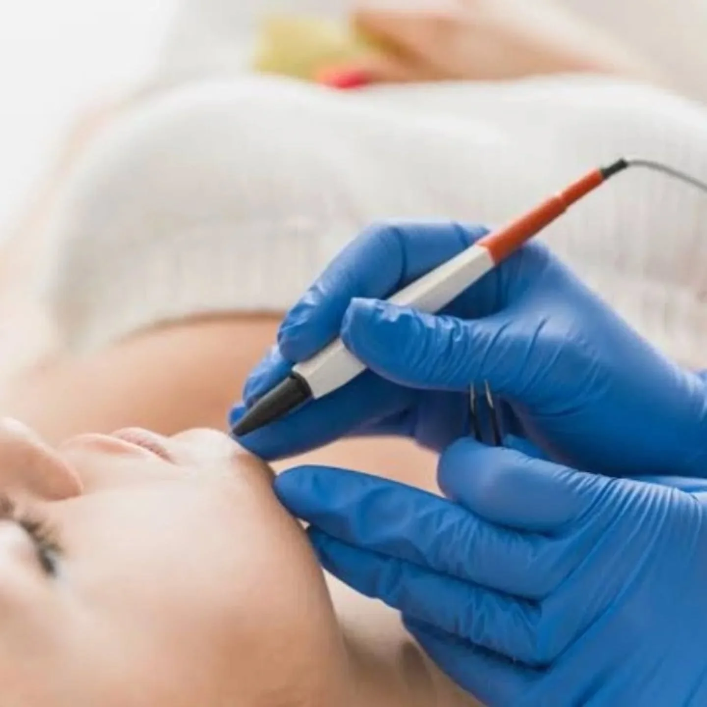 Tired of temporary hair removal?

Electrolysis is the only FDA approved method for permanent hair removal 💫

No more waxing appointments.
No more shaving every other day.
No more worrying about stubborn hairs coming back.

Electrolysis treats each h