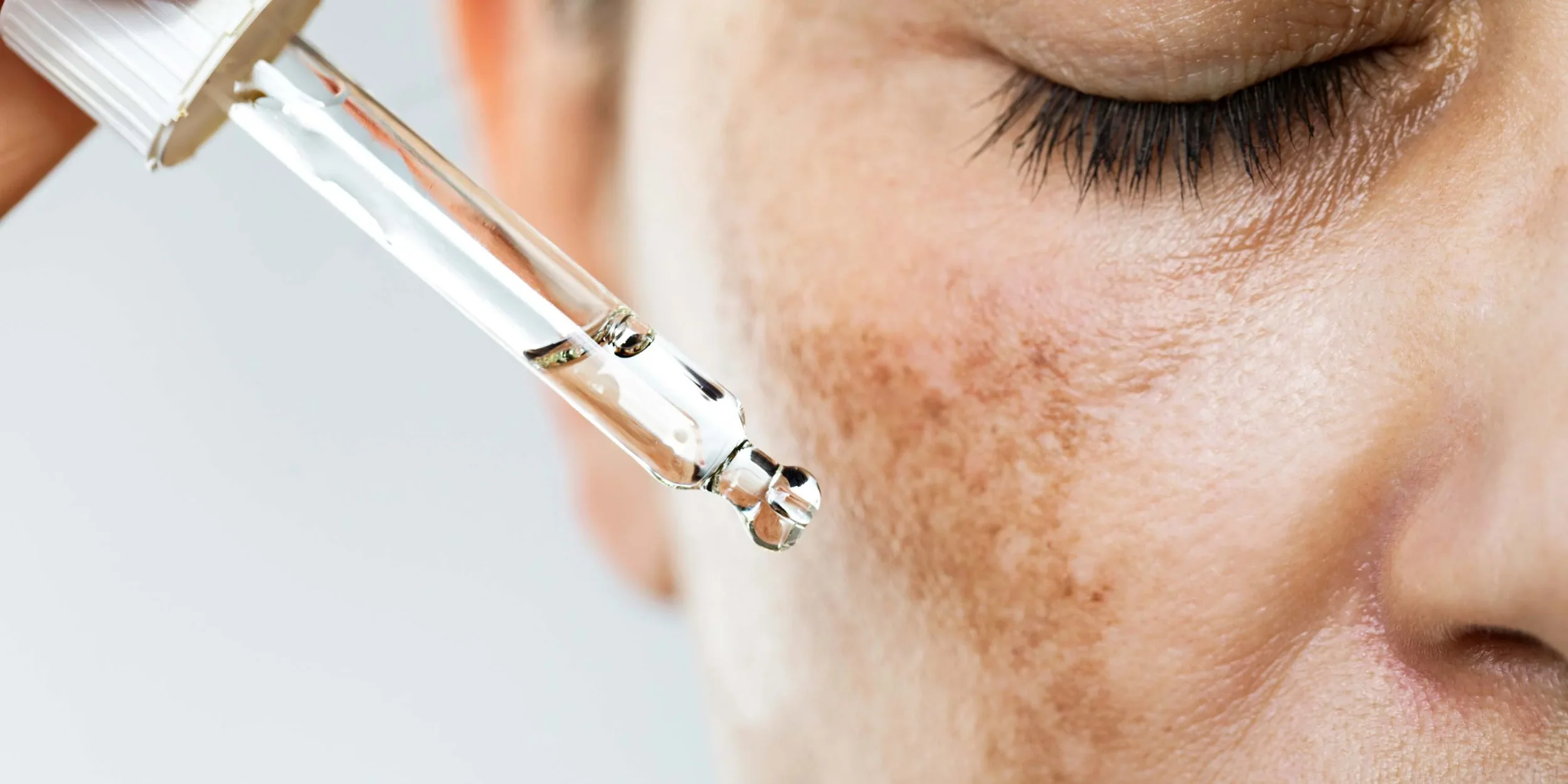 Why Fall Is the Perfect Time to Treat Hyperpigmentation