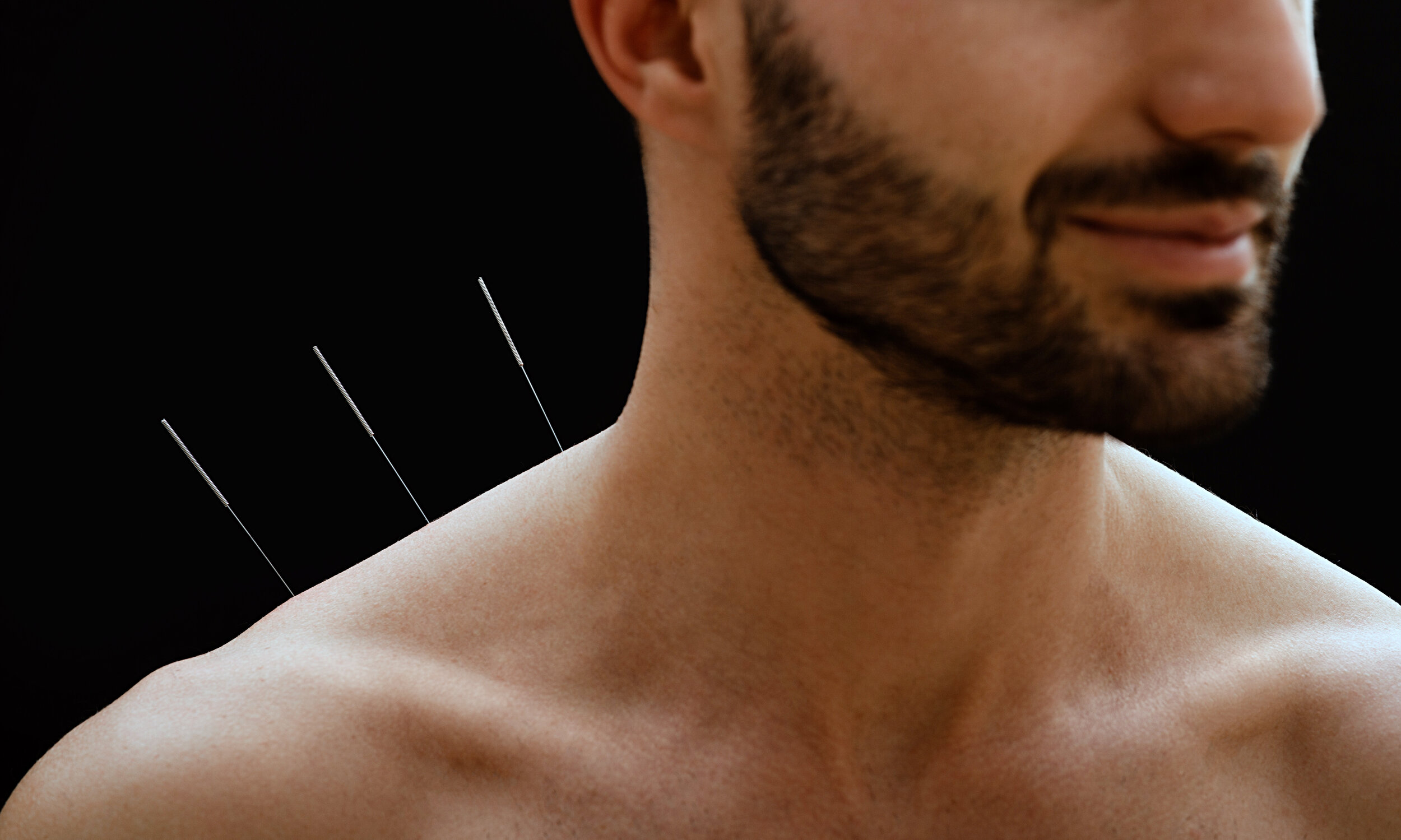 About — Michigan Acupuncture Clinics