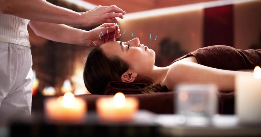The Role of Skilled Acupuncturists in Managing Everyday Pain and Stress