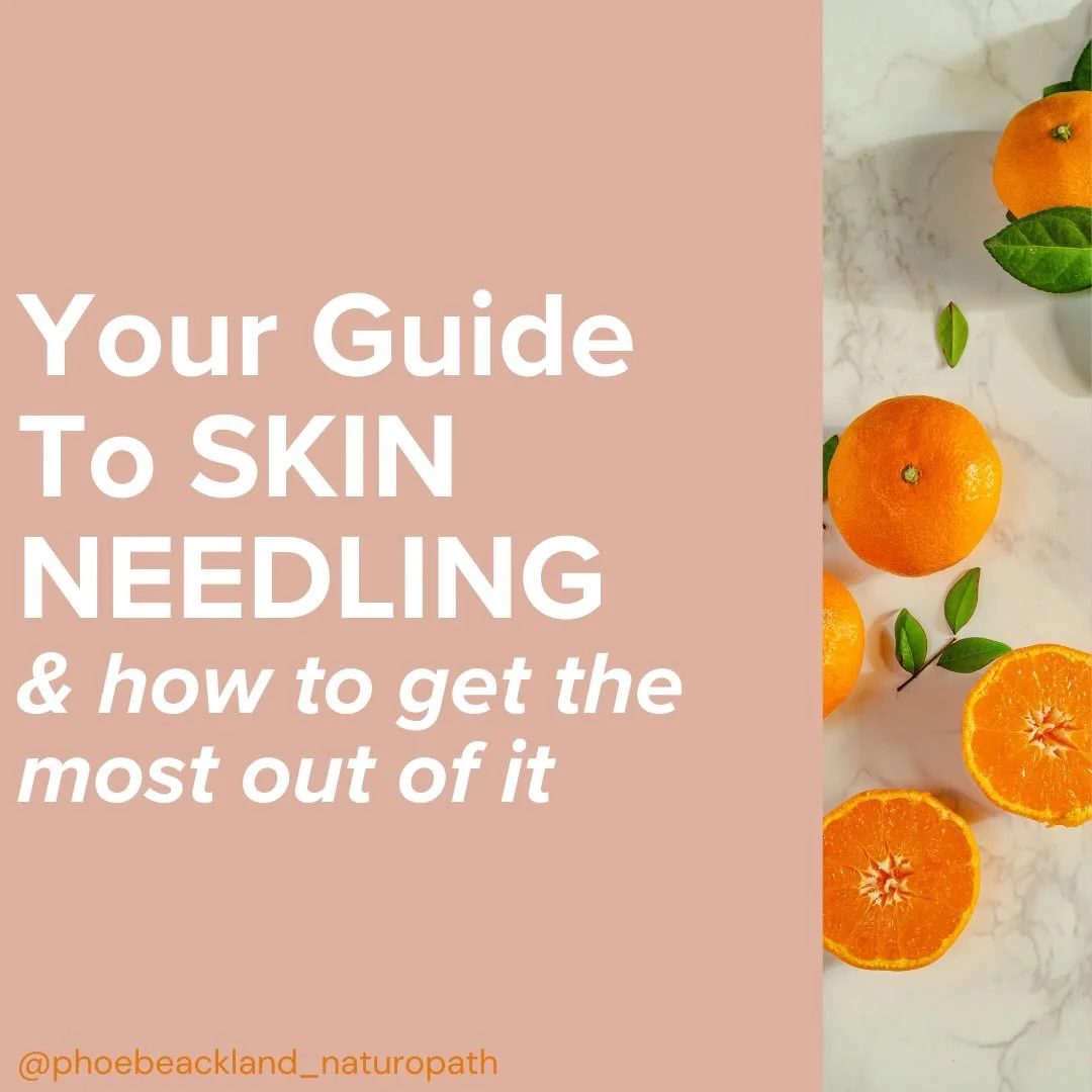 When my acne clients say that their skin therapist thinks they&rsquo;re just about ready for SKIN NEEDLING, I do a happy dance 🍊 🍋 holistic skin therapists only needle when acne is really nice and settled so it&rsquo;s SUCH an amazing sign of progr