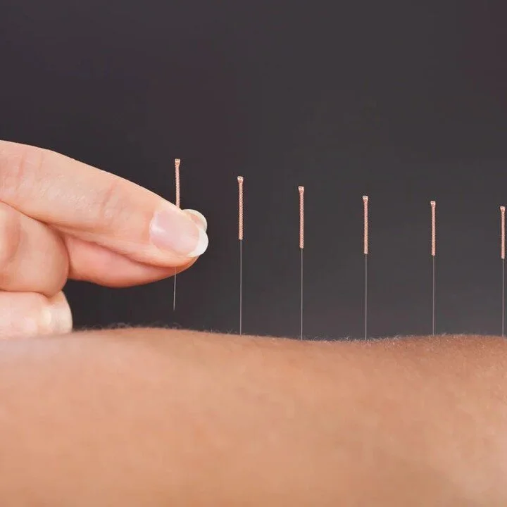 “What If I Feel Worse After Acupuncture?” — Very Well Acupuncture Baltimore