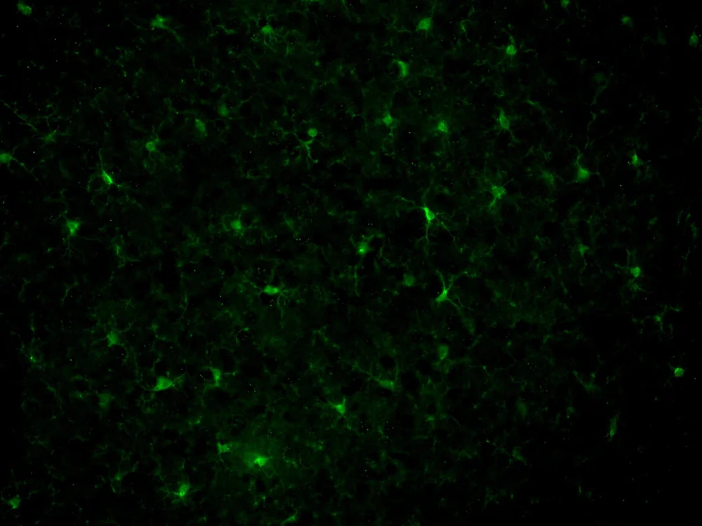 Conference — microglia.info