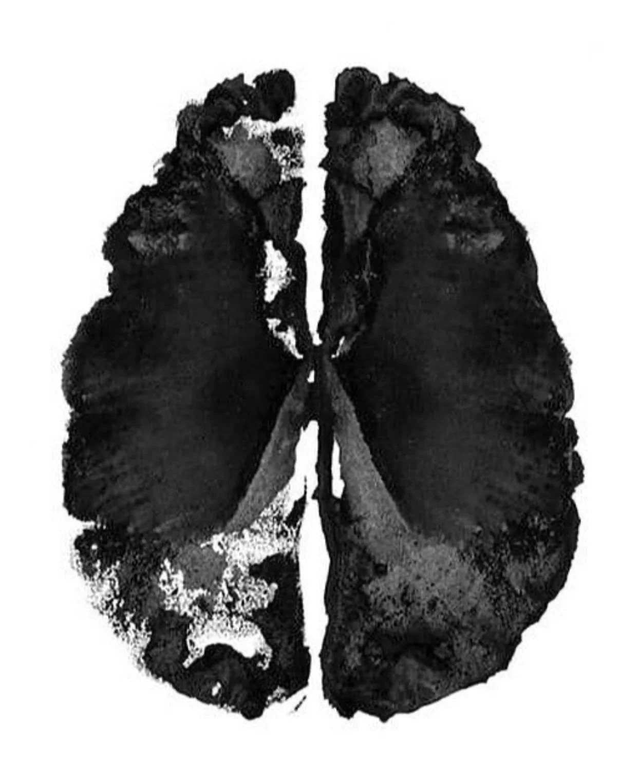 Brain Performance is Taking a Quantum Leap with SOFOS Associates