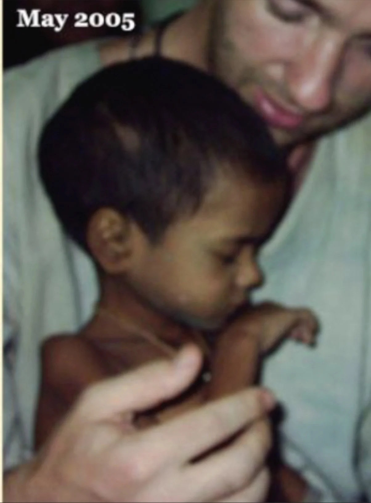 In 2015 Mothers First transitioned from a program treating severe malnutrition in children