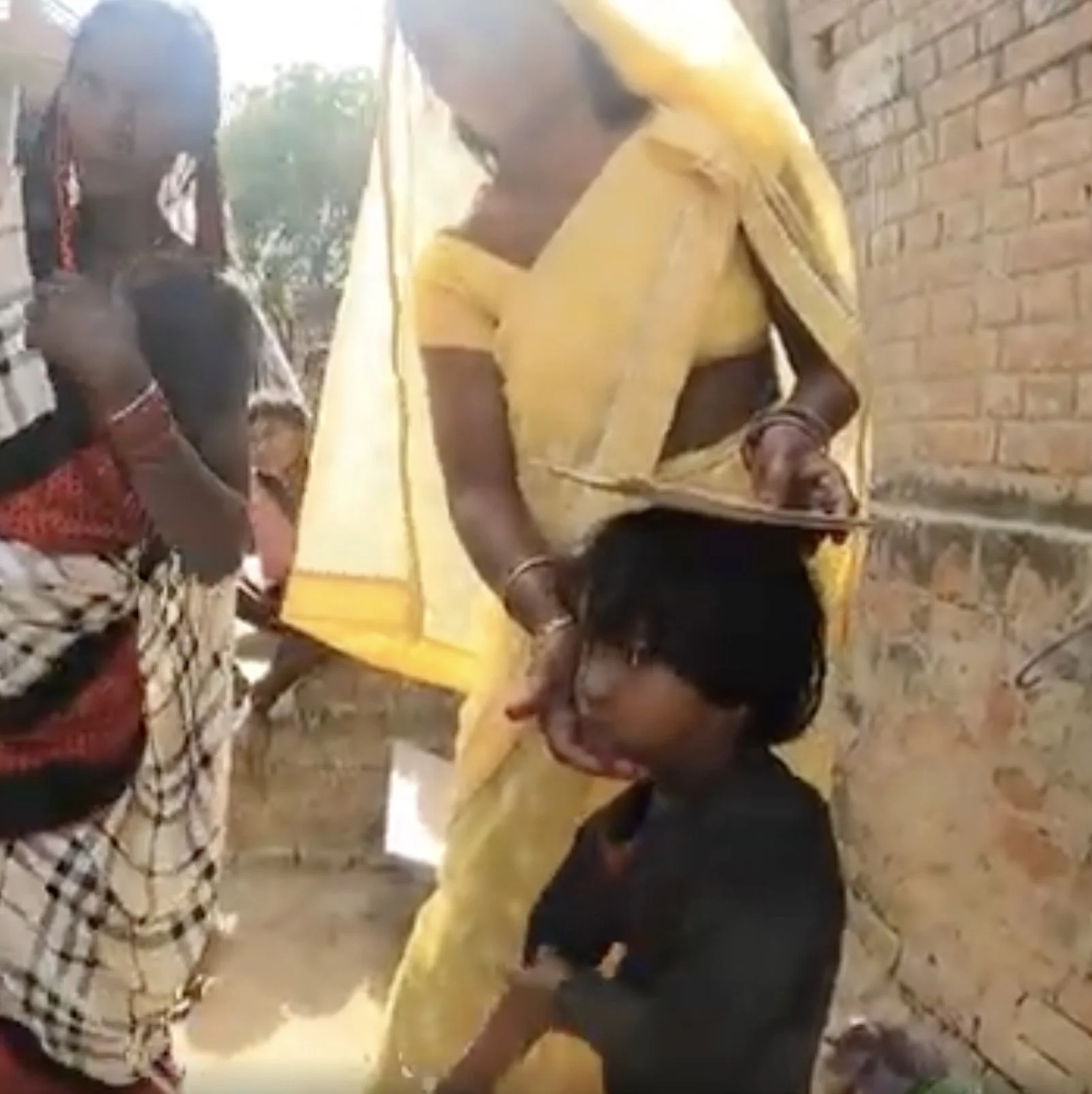 severe malnutrition in children no longer exists in these villages.